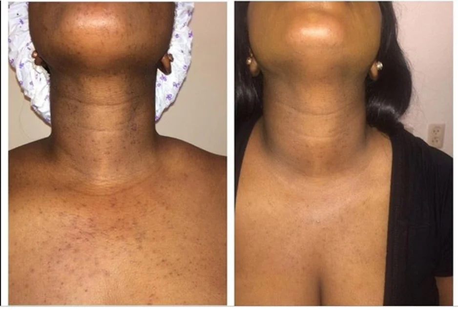 Turmeric Body Srub